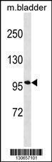 Anti-ENPP1 Rabbit Polyclonal Antibody (HRP (Horseradish Peroxidase))