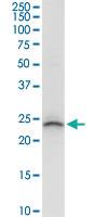 Anti-BCAP29 Rabbit Polyclonal Antibody