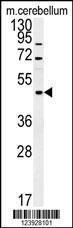 Anti-FUS Rabbit Polyclonal Antibody (FITC (Fluorescein Isothiocyanate))