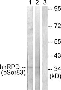 Western blot analysis of lysates from HUVEC and 293 cells using Anti-hnRPD (phospho Ser83) Antibody The right hand lane represents a negative control, where the antibody is blocked by the immunising peptide