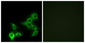 Immunofluorescence analysis of LOVO cells using Anti-GPBAR Antibody. The right hand panel represents a negative control, where the antibody was pre-incubated with the immunising peptide