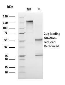 SDS-PAGE analysis of Anti-CD1a Antibody [C1A/3249] under non-reduced and reduced conditions; showing intact IgG and intact heavy and light chains, respectively. SDS-PAGE analysis confirms the integrity and purity of the antibody.