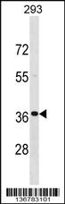 Anti-TNNT3 Rabbit Polyclonal Antibody