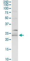 Anti-BCAP29 Rabbit Polyclonal Antibody