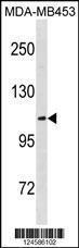 Anti-ENPP3 Rabbit Polyclonal Antibody (AP (Alkaline Phosphatase))