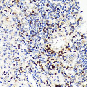 Immunohistochemistry analysis of paraffin-embedded human appendix tissue using Anti-PAX5 Antibody [ARC1654] (A305552) at a dilution of 1:100 (40X lens). Perform microwave antigen retrieval with 10 mM Tris/EDTA buffer pH 9.0 before commencing with IHC staining protocol