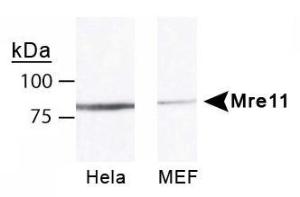 Anti-MRE11A Rabbit Polyclonal Antibody