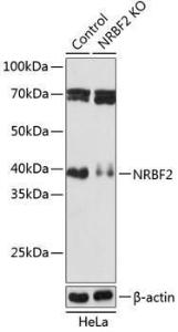 Western blot analysis of extracts from normal (control) and NRBF2 knockout (KO) HeLa cells, using Anti-NRBF2 Antibody (A306512) at 1:1,000 dilution. The secondary antibody was Goat Anti-Rabbit IgG H&L Antibody (HRP) at 1:10,000 dilution.