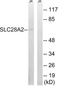 Western blot analysis of lysates from Jurkat cells using Anti-SLC28A2 Antibody The right hand lane represents a negative control, where the antibody is blocked by the immunising peptide