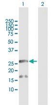 Anti-BCAP29 Rabbit Polyclonal Antibody