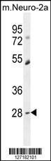 Anti-DPCD Rabbit Polyclonal Antibody (Biotin)