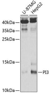 Western blot analysis of extracts of various cell lines, using Anti-Elafin / ESI Antibody (A11834) at 1:1,000 dilution. The secondary antibody was Goat Anti-Rabbit IgG H&L Antibody (HRP) at 1:10,000 dilution.