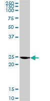 Anti-BCAP29 Rabbit Polyclonal Antibody