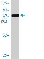 Anti-UBE2Q2 Mouse Monoclonal Antibody [clone: 5E7]