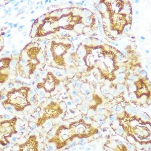 Immunohistochemistry analysis of paraffin-embedded rat kidney using Anti-Aquaporin 1 Antibody [ARC0925] (A306513) at a dilution of 1:100 (40x lens). Perform microwave antigen retrieval with 10 mM PBS buffer pH 7.2 before commencing with IHC staining protocol