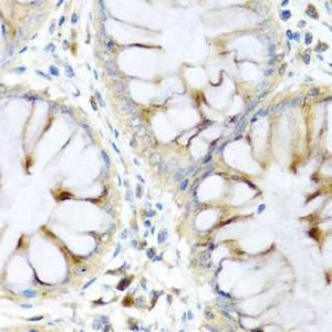 Immunohistochemistry analysis of paraffin-embedded human colon tissue using Anti-Elafin / ESI Antibody (A11834) at a dilution of 1:100 (40x lens). Perform microwave antigen retrieval with 10 mM PBS buffer pH 7.2 before commencing with IHC staining protocol.