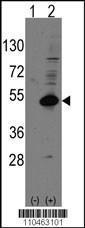 Anti-NR0B11 Rabbit Polyclonal Antibody