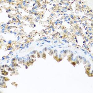 Immunohistochemistry analysis of paraffin-embedded mouse lung using Anti-Elafin / ESI Antibody (A11834) at a dilution of 1:100 (40x lens). Perform microwave antigen retrieval with 10 mM PBS buffer pH 7.2 before commencing with IHC staining protocol.