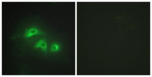 Immunofluorescence analysis of HepG2 cells using Anti-KAD1 Antibody . The right hand panel represents a negative control, where the antibody was pre-incubated with the immunising peptide.