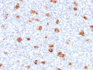 Immunohistochemical analysis of formalin-fixed, paraffin-embedded Hodgkin's lymphoma using Anti-Bcl-X Antibody [SPM519]