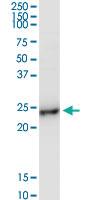 Anti-BCAP29 Rabbit Polyclonal Antibody