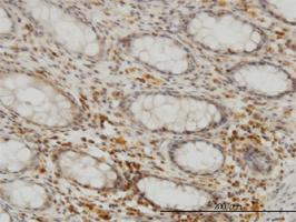 Anti-SEPHS2 Mouse Monoclonal Antibody [clone: 2G9]