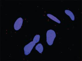 Anti-MYC Antibody Pair