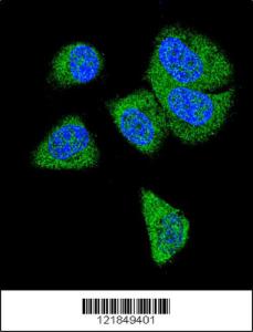 Anti-C6 Rabbit Polyclonal Antibody (AP (Alkaline Phosphatase))