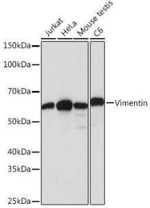 Western blot analysis of extracts of various cell lines, using Anti-Vimentin Antibody [ARC0086] (A305554) at 1:1000 dilution. The secondary Antibody was Goat Anti-Rabbit IgG H&L Antibody (HRP) at 1:10000 dilution.