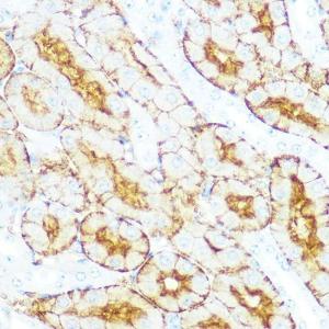 Immunohistochemistry analysis of paraffin-embedded mouse kidney using Anti-Aquaporin 1 Antibody [ARC0925] (A306513) at a dilution of 1:100 (40x lens). Perform microwave antigen retrieval with 10 mM PBS buffer pH 7.2 before commencing with IHC staining protocol