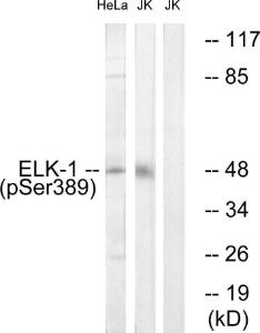 Western blot analysis of lysates from Jurkat cells treated with UV 15' and HeLa cells treated with paclitaxel 1uM 24h using Anti-Elk1 (phospho Ser389) Antibody. The right hand lane represents a negative control, where the antibody is blocked by the immunising peptide.