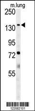 Anti-ATP11C Rabbit Polyclonal Antibody (HRP (Horseradish Peroxidase))