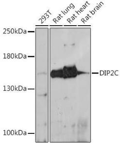 Western blot analysis of extracts of various cell lines, using Anti-DIP2C Antibody (A306514) at 1:1,000 dilution The secondary antibody was Goat Anti-Rabbit IgG H&L Antibody (HRP) at 1:10,000 dilution Lysates/proteins were present at 25 µg per lane