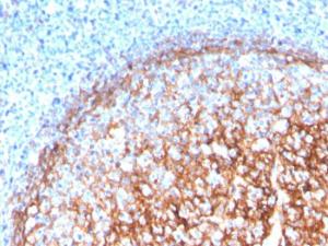 Anti-CD11b antibody