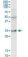 Anti-BCAP29 Rabbit Polyclonal Antibody