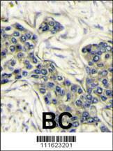 Anti-PI3KCA Rabbit Polyclonal Antibody (Biotin)