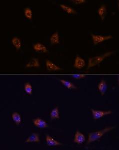 Immunofluorescence analysis of L929 cells using Anti-DIP2C Antibody (A306514) at a dilution of 1:100 DAPI was used to stain the cell nuclei (blue)