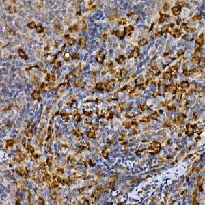 Immunohistochemistry analysis of paraffin-embedded rat spleen using Anti-MERTK Antibody (A11835) at a dilution of 1:100 (40x lens). Perform high pressure antigen retrieval with 10 mM citrate buffer pH 6.0 before commencing with IHC staining protocol