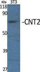 Western blot analysis of various cells using Anti-SLC28A2 Antibody