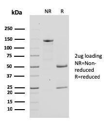 SDS-PAGE analysis of Anti-Bcl-X Antibody [SPM519] under non-reduced and reduced conditions; showing intact IgG and intact heavy and light chains, respectively. SDS-PAGE analysis confirms the integrity and purity of the Antibody