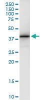 Anti-JMJD7-PLA2G4B Polyclonal Antibody Pair