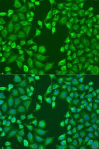 Immunofluorescence analysis of U2OS using Anti-MERTK Antibody (A11835) at a dilution of 1:100 (40x lens). DAPI was used to stain the cell nuclei (blue)