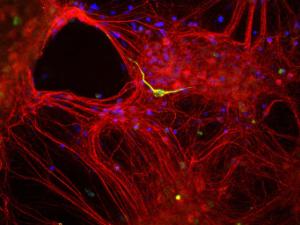 Mixed neuron-glial cultures stained with Anti-Alpha-Internexin Antibody (red) and Anti-Peripherin Antibody (A85435 / green). The Anti-Alpha-Internexin Antibody stains numerous axonal and dendritic profiles in these cultures, while Anti-Peripherin Antibody binds to only a subset of neurons.