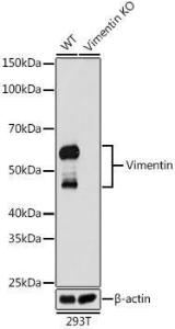 Western blot analysis of extracts from wild type (WT) and Vimentin knockout (KO) 293T cells, using Anti-Vimentin Antibody [ARC0086] (A305554) at 1:1000 dilution. The secondary Antibody was Goat Anti-Rabbit IgG H&L Antibody (HRP) at 1:10000 dilution