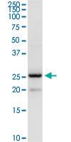 Anti-BCAP29 Rabbit Polyclonal Antibody