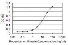 Anti-RNF133 Mouse Monoclonal Antibody [clone: 3D6]