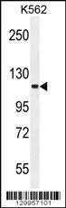 Anti-SKOR2 Rabbit Polyclonal Antibody (Biotin)