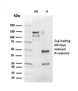 SDS-PAGE analysis of Anti-Cyclin D1 Antibody [rCCND1/4752] under non-reduced and reduced conditions; showing intact IgG and intact heavy and light chains, respectively. SDS-PAGE analysis confirms the integrity and purity of the antibody