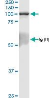 Anti-RAPGEF3 Rabbit Polyclonal Antibody