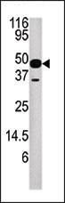 Anti-NUP54 Rabbit Polyclonal Antibody